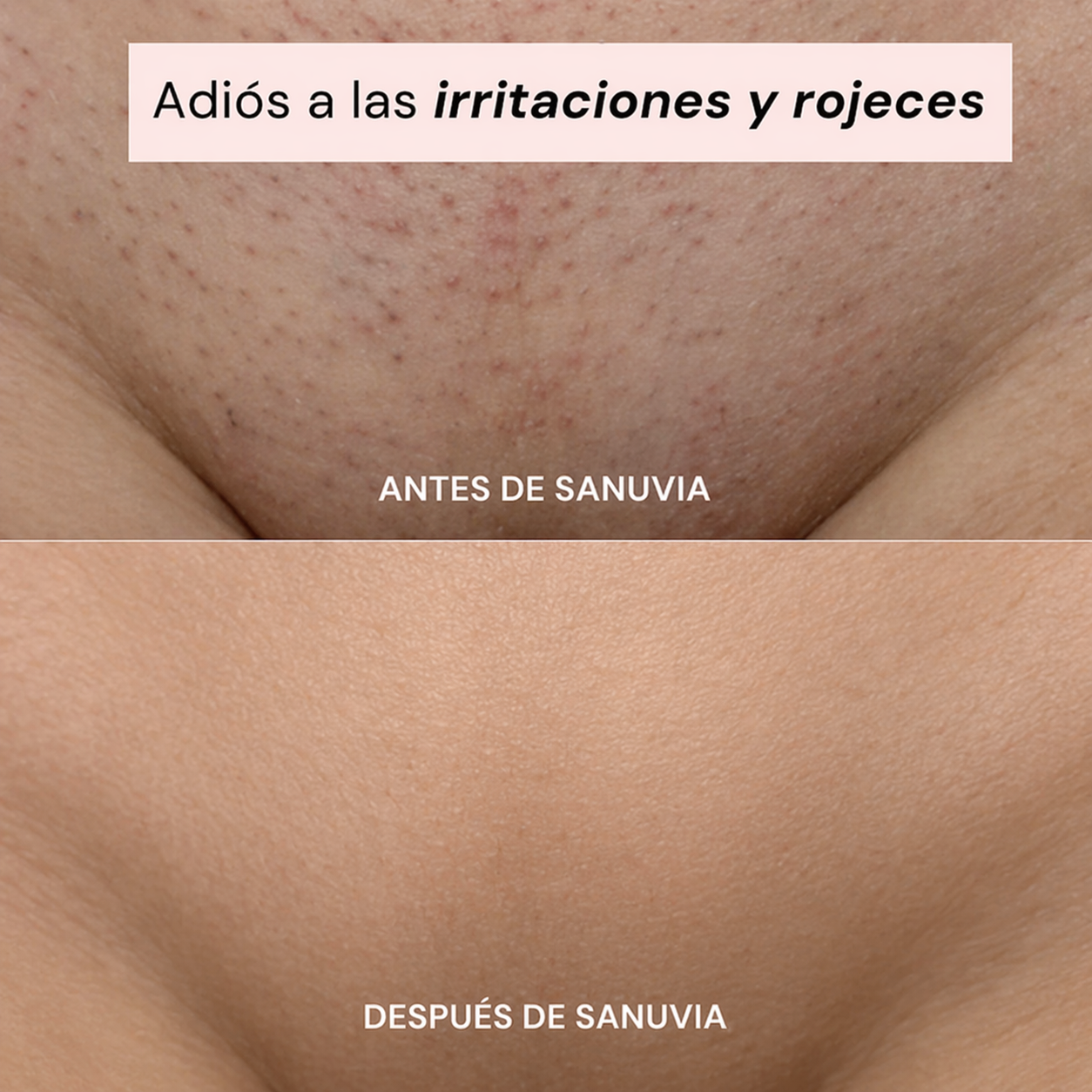 SANUVIA - Depiladora Íntima 2 en 1