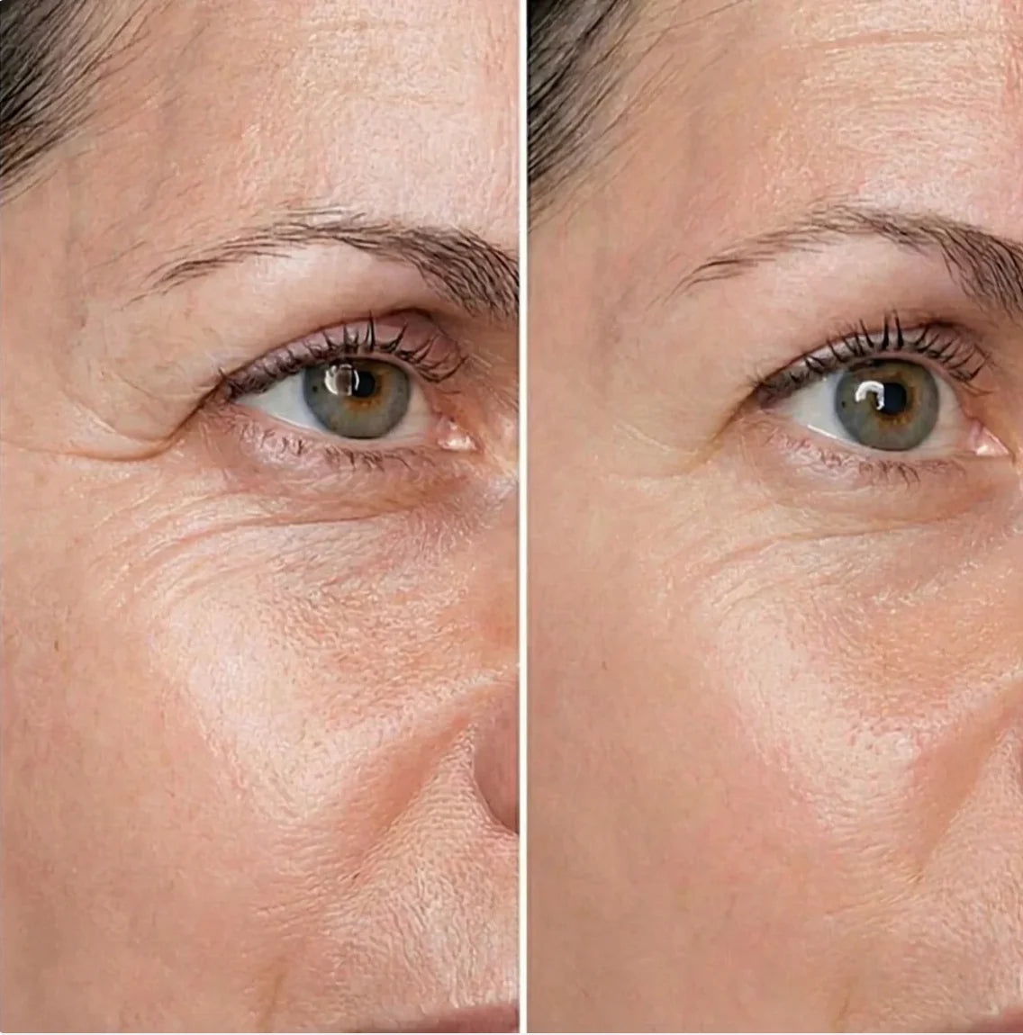 Crema Antiedad SANUVIA: Piel visiblemente más joven. Sin irritación.