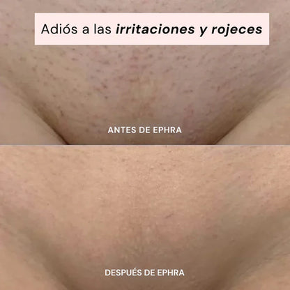 EPHRA - Depiladora Íntima 2 en 1